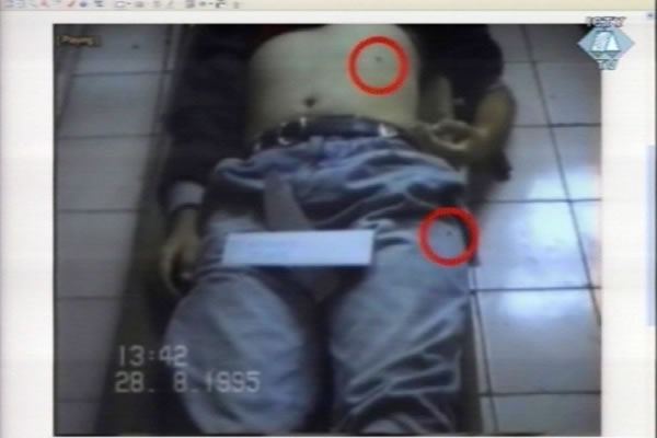 Fotografija tijela Vehida Komara u sarajevskoj mrtvačnici